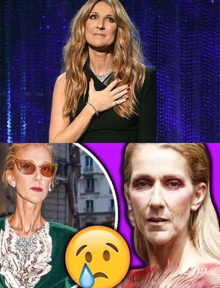 Celine Dion anulează toate concertele până în 2024 din cauza unei afecțiuni rare și grave.